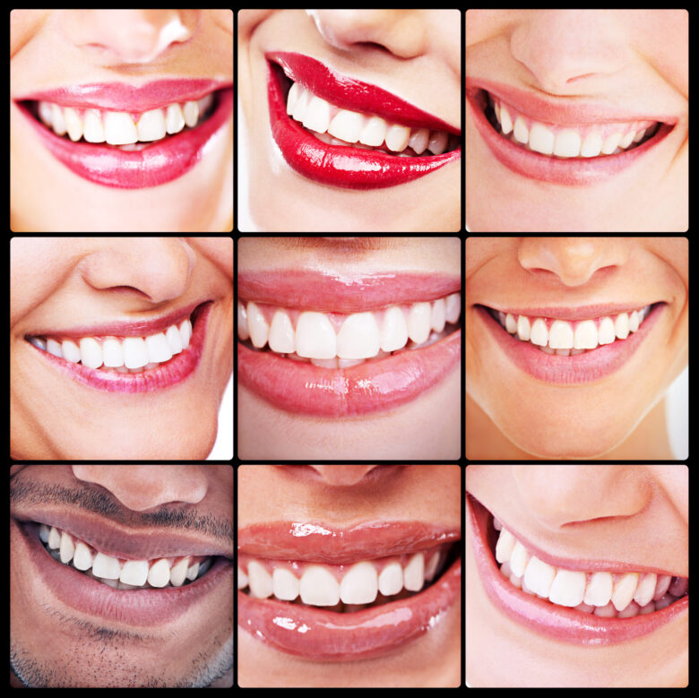 Quadro com composição de sorrisos