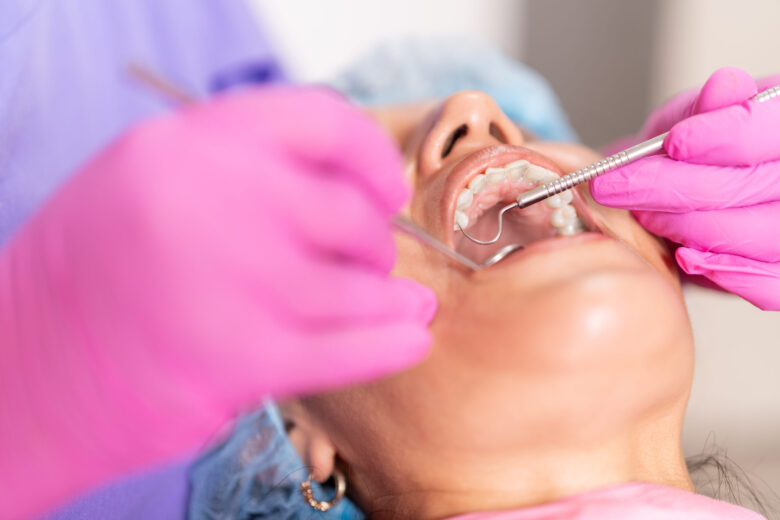 limpeza dentária