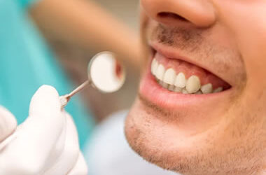 Gengiva após implante dentário - 2