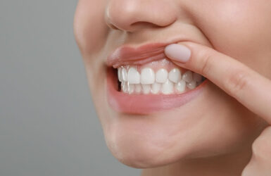 reabilitação-oral-3