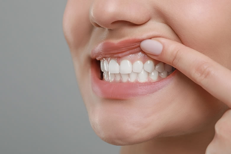 reabilitação-oral-3